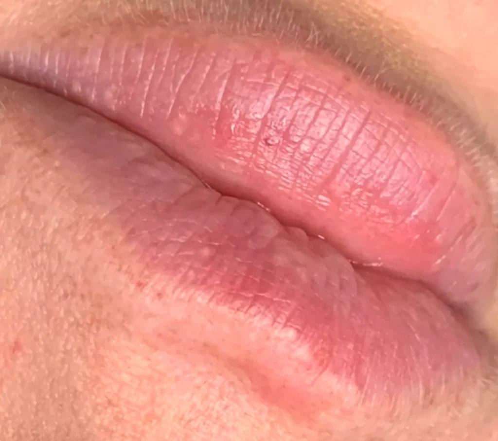 can I wipe my lips after lip tattoo