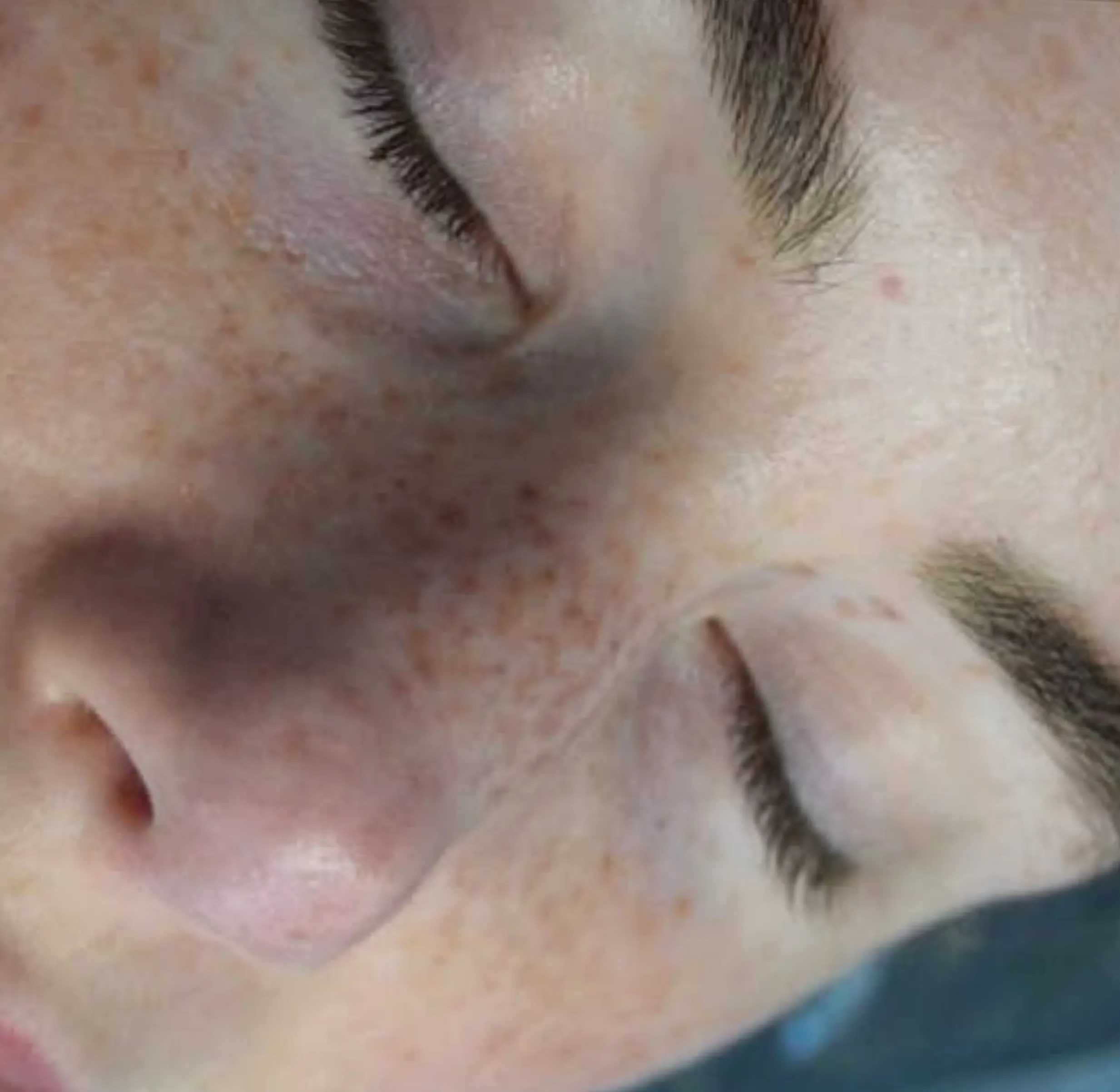natural eyeliner tattoo Melbourne
