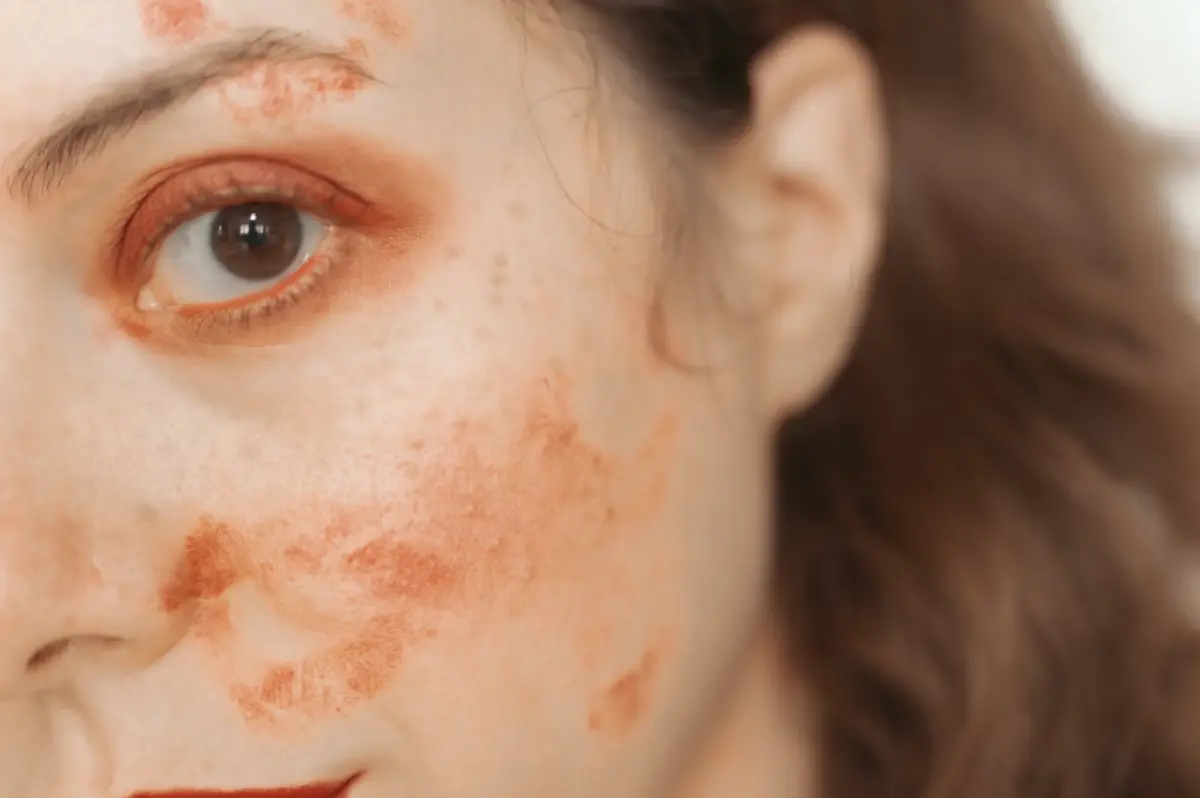 overwashing face side effects